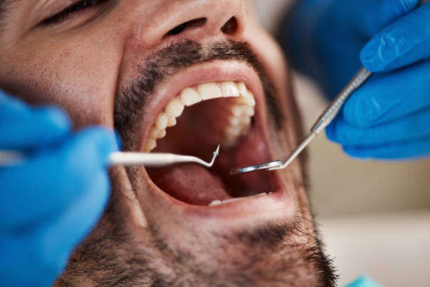 Dental Inlays and Onlays in Elmwood Park, IL